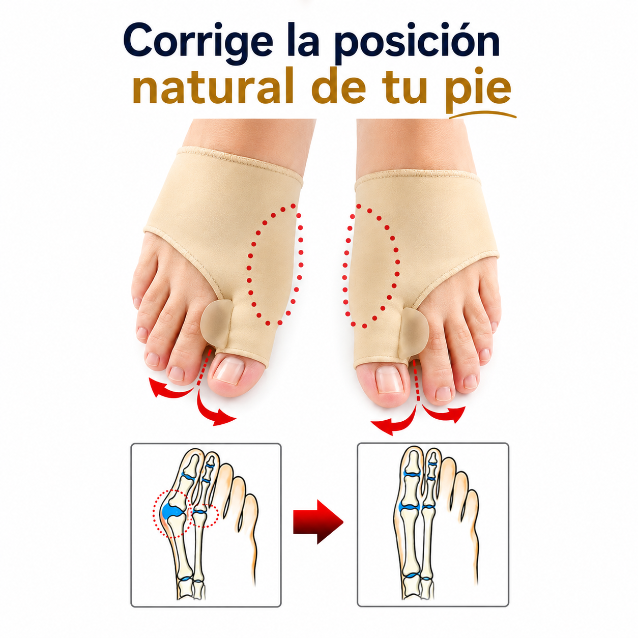 PediComfort™ - Corrector De Juanetes 2x1